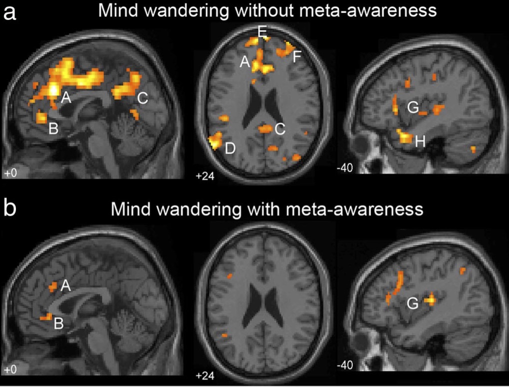 Mind Wandering The Redirect Anxiety Habit